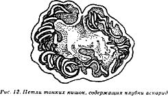 Жизнь без паразитов
