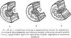 Жизнь без паразитов
