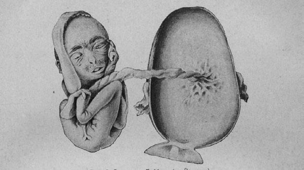 Илья Мечников - Этюды о природе человека