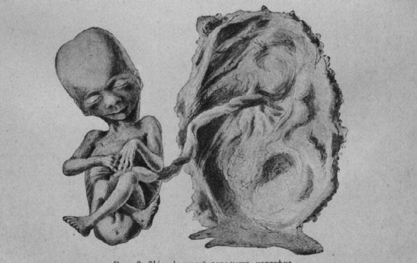 Илья Мечников - Этюды о природе человека