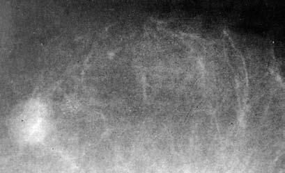 Коллектив авторов - Избранные лекции по факультетской хирургии: учебное пособие