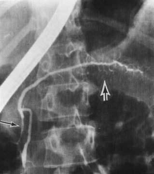 Коллектив авторов - Избранные лекции по факультетской хирургии: учебное пособие