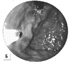 Коллектив авторов - Избранные лекции по факультетской хирургии: учебное пособие
