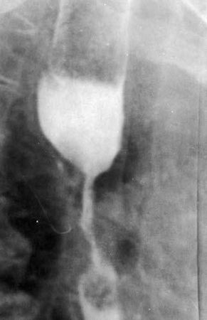 Коллектив авторов - Избранные лекции по факультетской хирургии: учебное пособие
