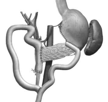 Коллектив авторов - Избранные лекции по факультетской хирургии: учебное пособие