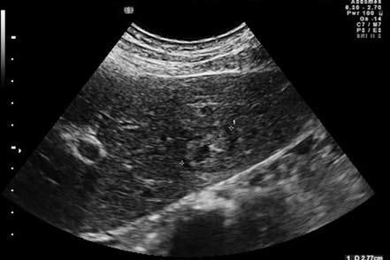 Коллектив авторов - Избранные лекции по факультетской хирургии: учебное пособие