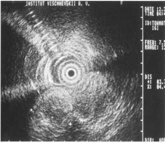 Коллектив авторов - Избранные лекции по факультетской хирургии: учебное пособие