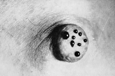 Коллектив авторов - Избранные лекции по факультетской хирургии: учебное пособие