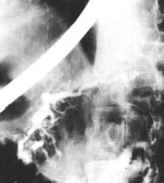 Коллектив авторов - Избранные лекции по факультетской хирургии: учебное пособие