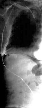 Коллектив авторов - Избранные лекции по факультетской хирургии: учебное пособие