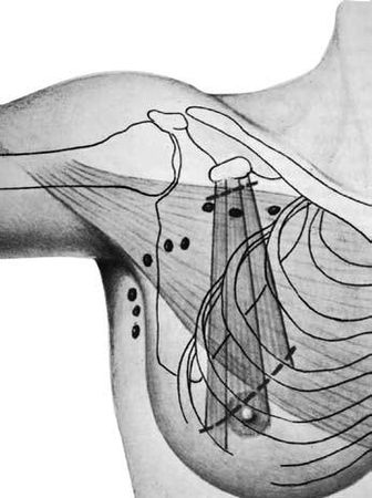 Коллектив авторов - Избранные лекции по факультетской хирургии: учебное пособие