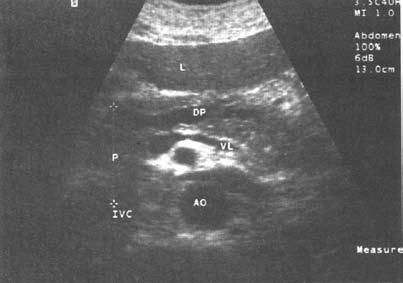 Коллектив авторов - Избранные лекции по факультетской хирургии: учебное пособие