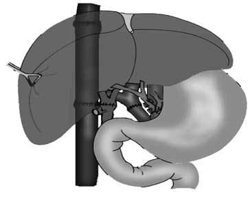 Коллектив авторов - Избранные лекции по факультетской хирургии: учебное пособие