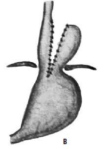 Коллектив авторов - Избранные лекции по факультетской хирургии: учебное пособие