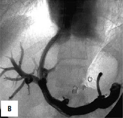 Коллектив авторов - Избранные лекции по факультетской хирургии: учебное пособие