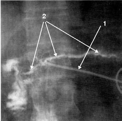 Коллектив авторов - Избранные лекции по факультетской хирургии: учебное пособие