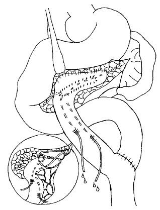 Коллектив авторов - Избранные лекции по факультетской хирургии: учебное пособие