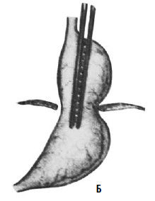 Коллектив авторов - Избранные лекции по факультетской хирургии: учебное пособие