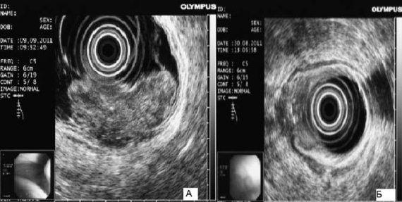 Коллектив авторов - Избранные лекции по факультетской хирургии: учебное пособие