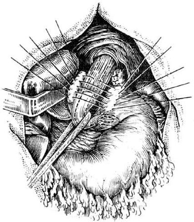 Коллектив авторов - Избранные лекции по факультетской хирургии: учебное пособие