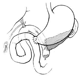 Коллектив авторов - Избранные лекции по факультетской хирургии: учебное пособие