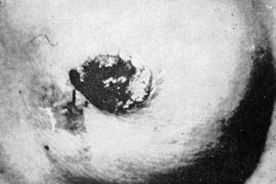 Коллектив авторов - Избранные лекции по факультетской хирургии: учебное пособие