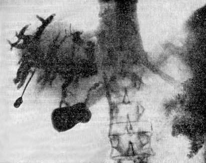 Коллектив авторов - Избранные лекции по факультетской хирургии: учебное пособие