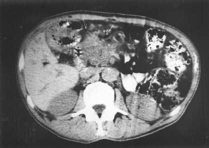 Коллектив авторов - Избранные лекции по факультетской хирургии: учебное пособие
