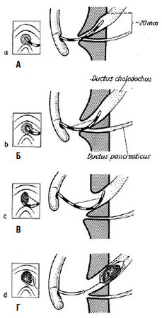 Коллектив авторов - Избранные лекции по факультетской хирургии: учебное пособие