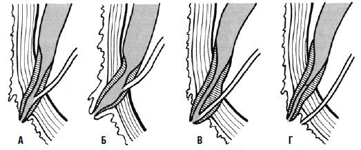 Коллектив авторов - Избранные лекции по факультетской хирургии: учебное пособие