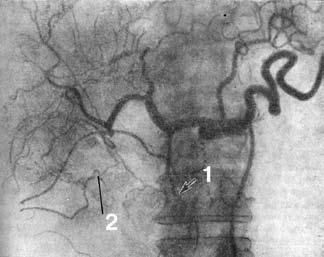 Коллектив авторов - Избранные лекции по факультетской хирургии: учебное пособие