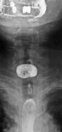 Коллектив авторов - Избранные лекции по факультетской хирургии: учебное пособие