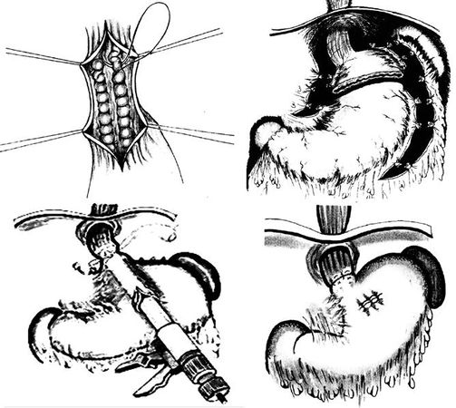 Коллектив авторов - Избранные лекции по факультетской хирургии: учебное пособие
