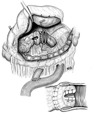Коллектив авторов - Избранные лекции по факультетской хирургии: учебное пособие