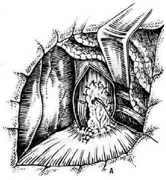 Коллектив авторов - Избранные лекции по факультетской хирургии: учебное пособие