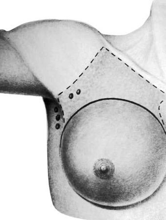 Коллектив авторов - Избранные лекции по факультетской хирургии: учебное пособие