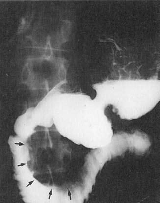 Коллектив авторов - Избранные лекции по факультетской хирургии: учебное пособие
