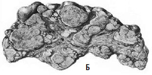 Коллектив авторов - Избранные лекции по факультетской хирургии: учебное пособие