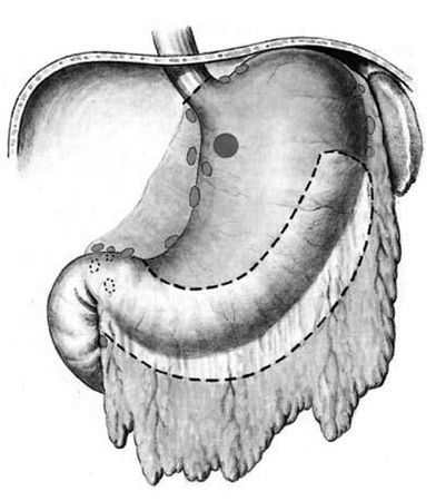 Коллектив авторов - Избранные лекции по факультетской хирургии: учебное пособие