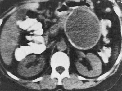 Коллектив авторов - Избранные лекции по факультетской хирургии: учебное пособие