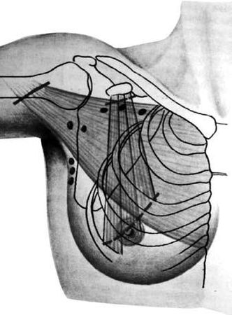Коллектив авторов - Избранные лекции по факультетской хирургии: учебное пособие