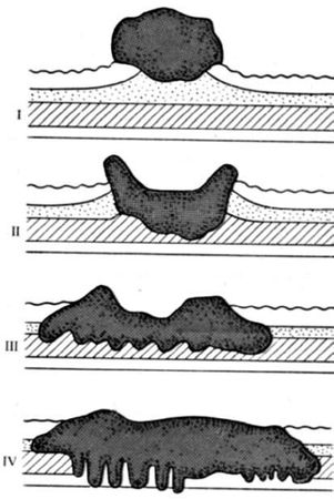 Коллектив авторов - Избранные лекции по факультетской хирургии: учебное пособие