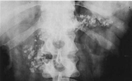Коллектив авторов - Избранные лекции по факультетской хирургии: учебное пособие