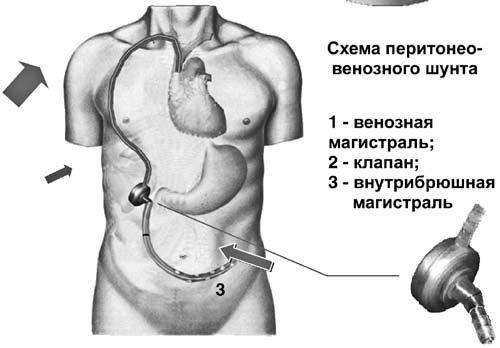 Коллектив авторов - Избранные лекции по факультетской хирургии: учебное пособие