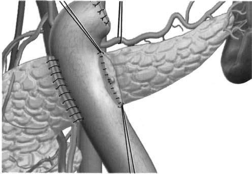 Коллектив авторов - Избранные лекции по факультетской хирургии: учебное пособие