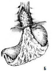 Коллектив авторов - Избранные лекции по факультетской хирургии: учебное пособие