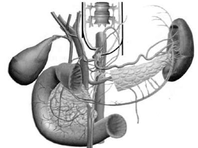 Коллектив авторов - Избранные лекции по факультетской хирургии: учебное пособие