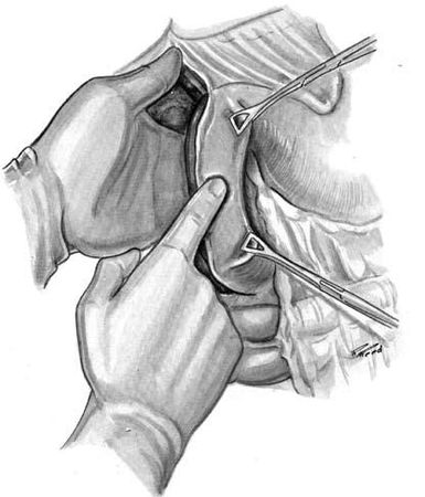 Коллектив авторов - Избранные лекции по факультетской хирургии: учебное пособие