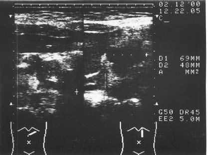 Коллектив авторов - Избранные лекции по факультетской хирургии: учебное пособие
