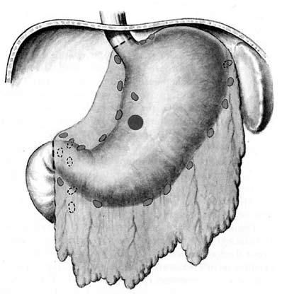 Коллектив авторов - Избранные лекции по факультетской хирургии: учебное пособие